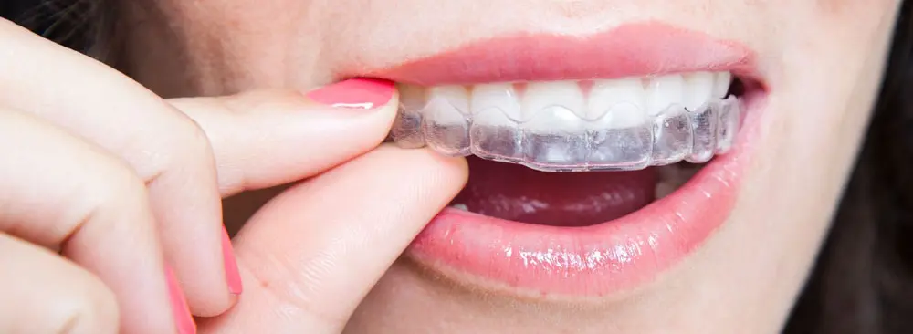 Adult braces for teeth Forced lesbian captions