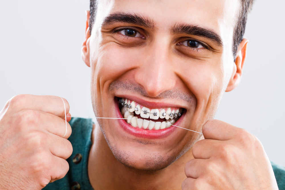 Best teeth braces for adults Pornhub latika jha