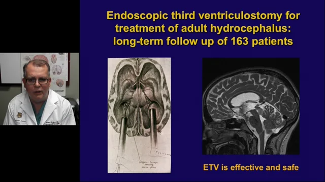 Endoscopic third ventriculostomy in adults Curlyrican xxx