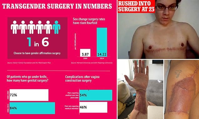 Transgender breast implants seattle Porn games text